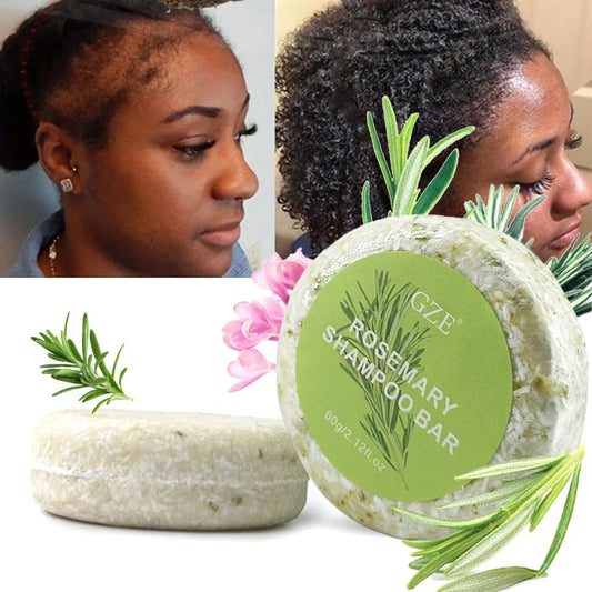 GZE Rosemary Hair Strengthens Shampoo Bar: Cleanses and Helps Strengthen Weak and Brittle Hair